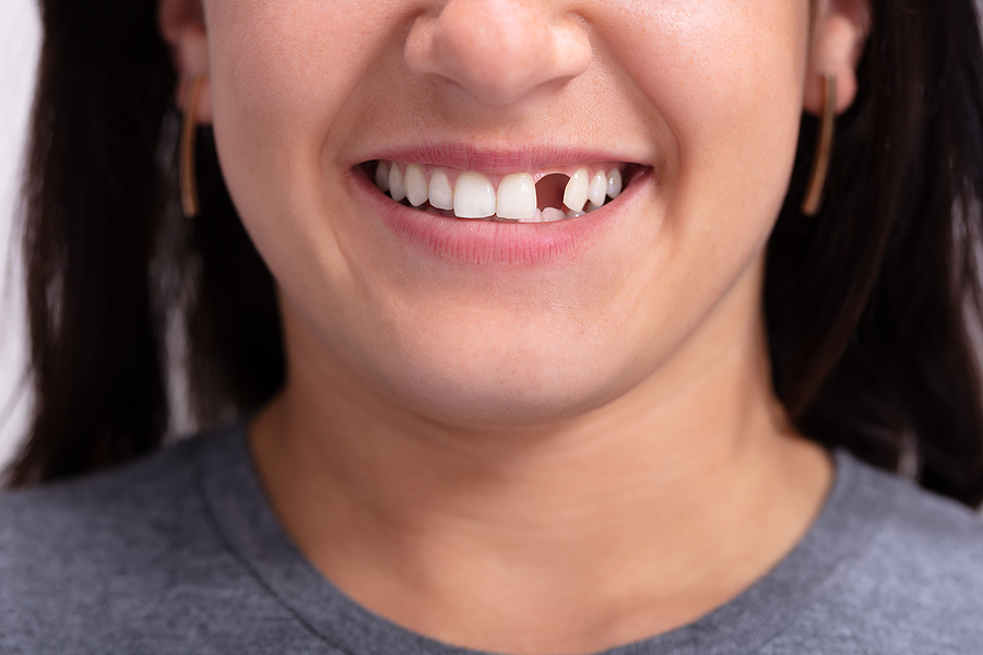 You Don’t Need To Look Like A Hockey Player