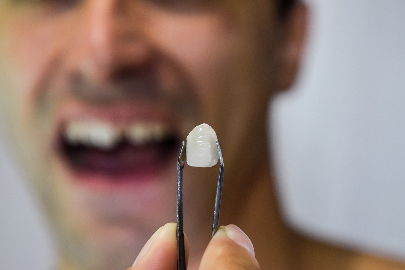 Restore The Teeth To A Better State