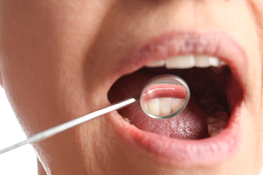 Periodontics Can Save Your Smile by Restoring Your Gums