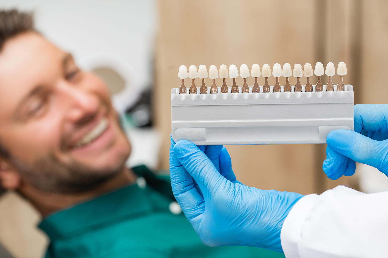 4 Benefits of Porcelain Veneers