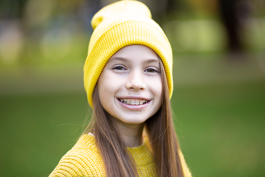 We Are the Best Dentist in Walnut Creek For Replacing Missing Teeth