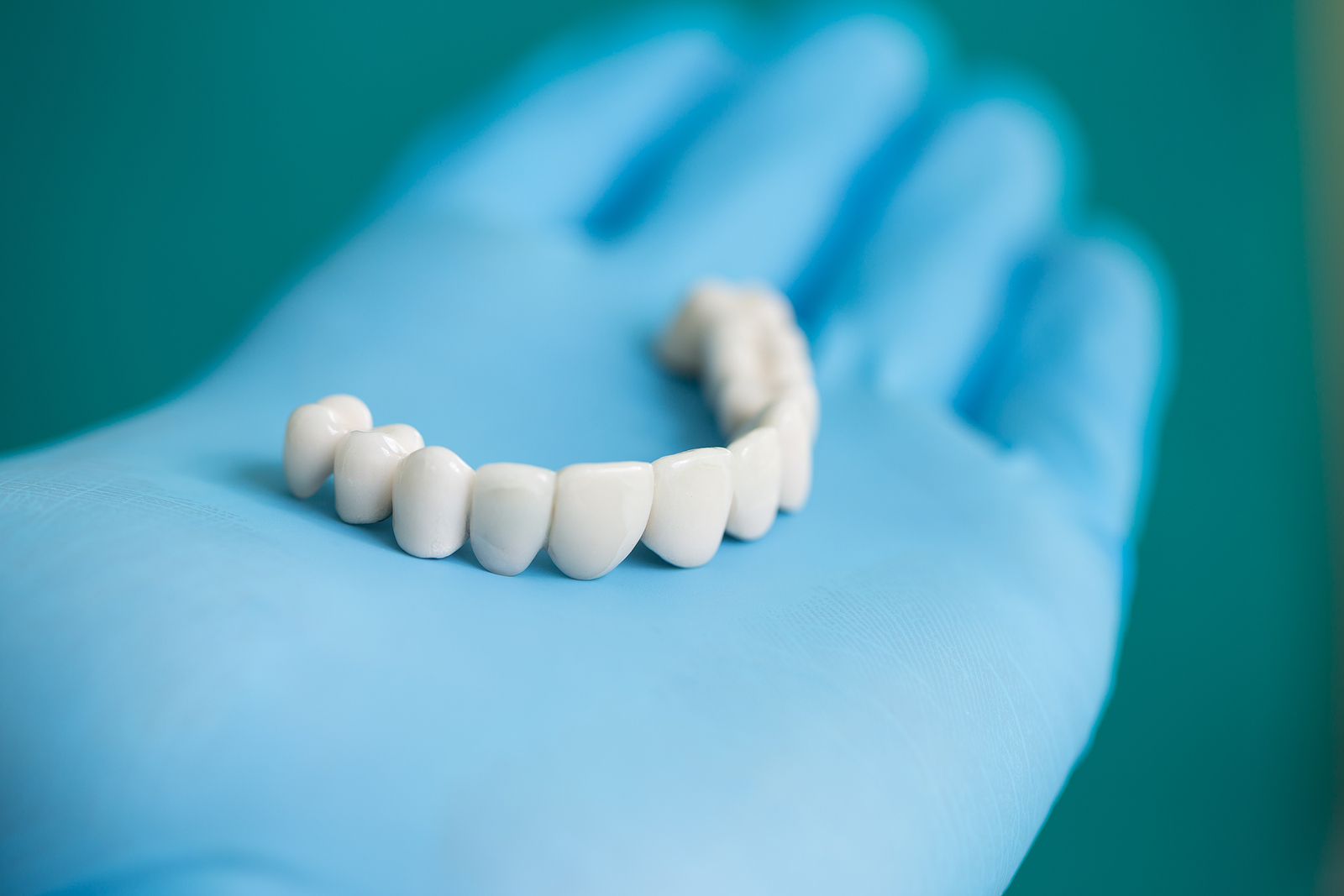 Who Is a Candidate for Dental Bridges?