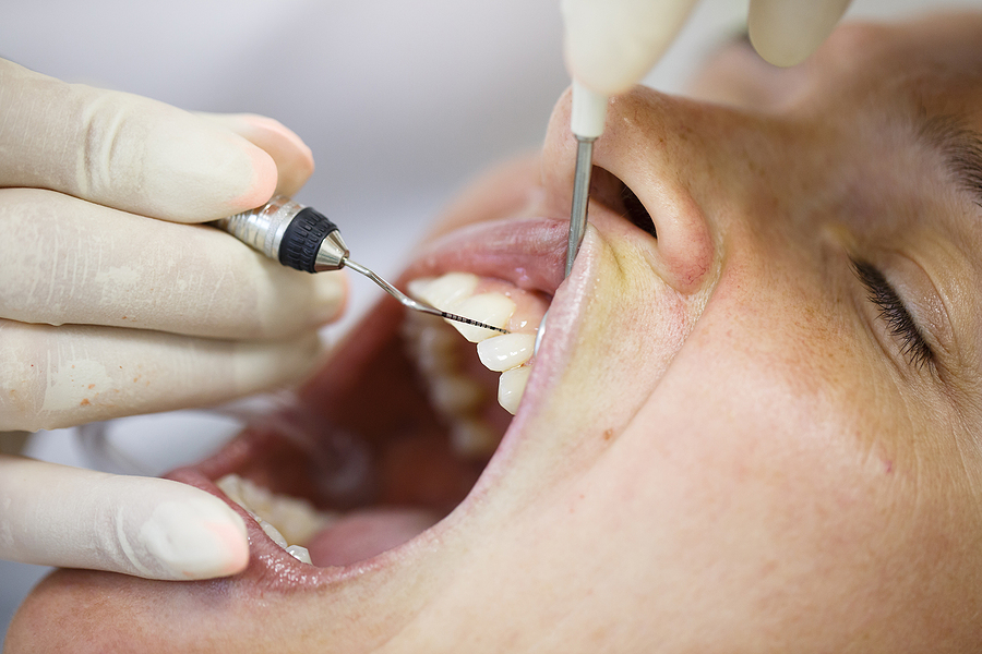 Comprehensive Periodontal Care: Understanding Periodontics in Walnut Creek, CA