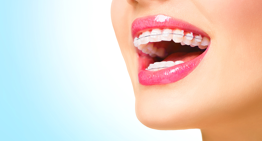 Do You Need a Root Canal? 5 Telltale Symptoms