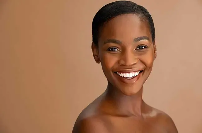 Smile Makeover Smile Makeover